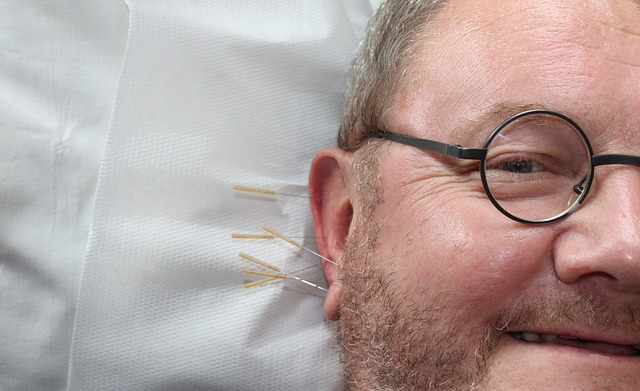 Acupuncture – Is It Right For Me?