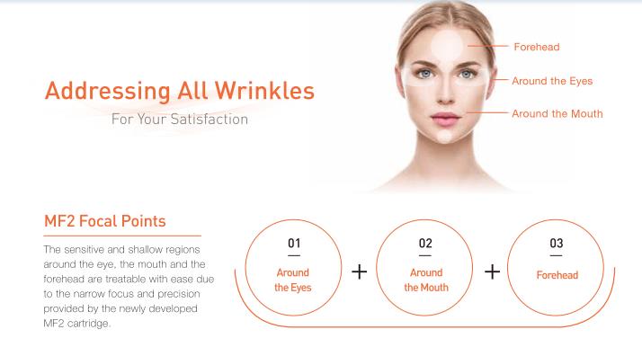 Face Lifting with Ultraformer III: A Comprehensive Guide