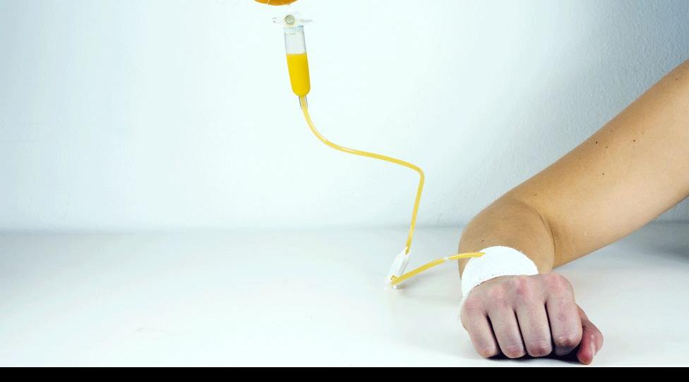 The Benefits of Vitamin C IV Drips: A Comprehensive Guide